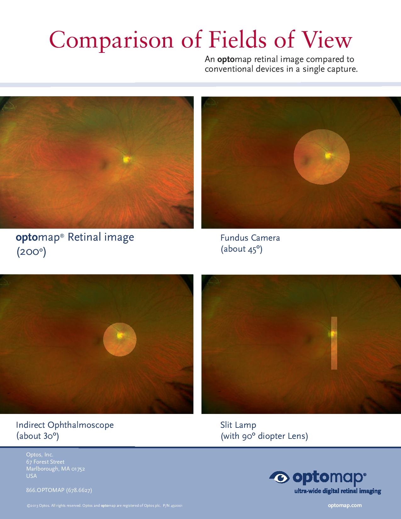 Retinal Imaging Eye Contact Opticians, London, Liverpool Street